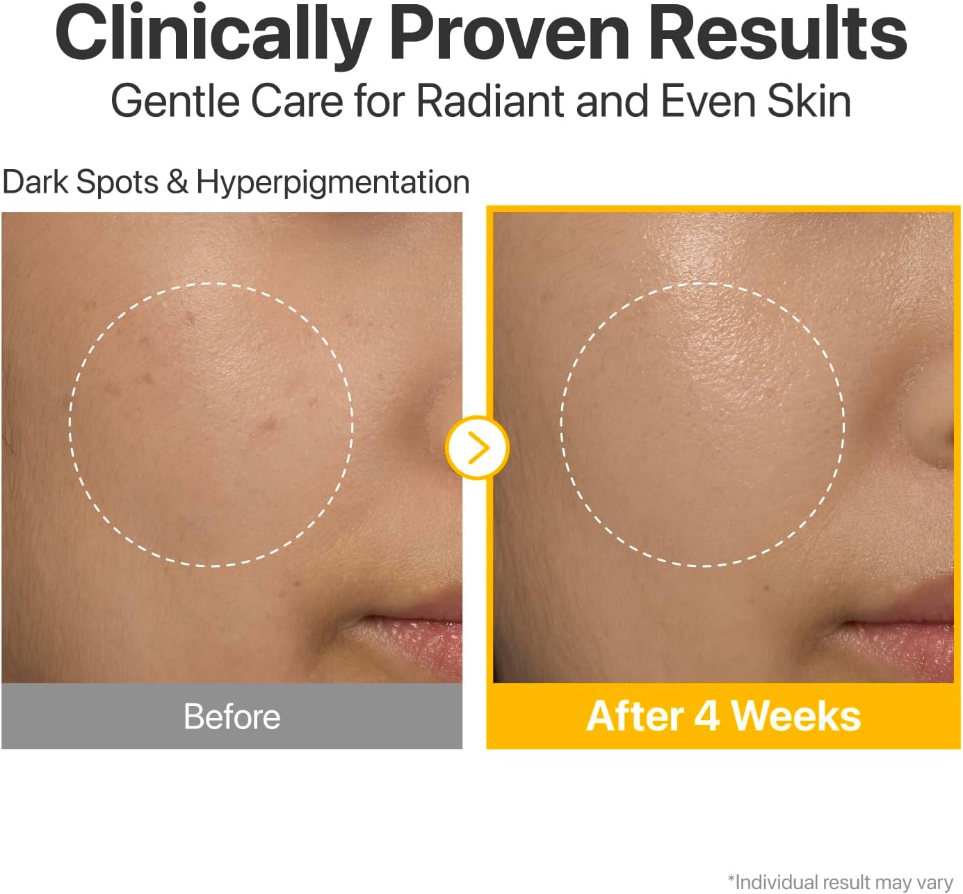 Numbuzin No.5+ Glutathione Vitamin Concentrated Serum