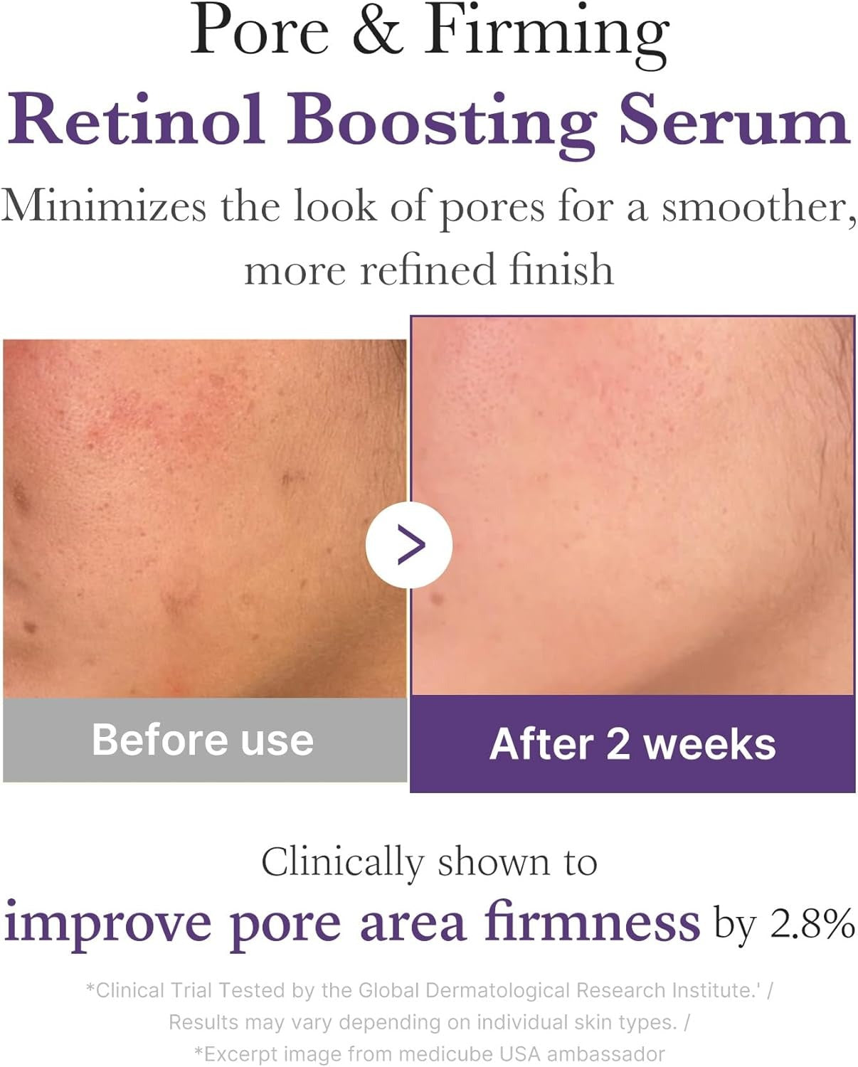 Medicube Retinol NMN Boosting Serum – Revive & Firm Night Elixir - 30 ml 