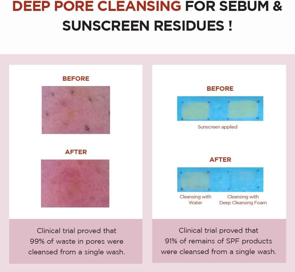 SKIN 1004 Poremizing Deep Cleansing Foam UAE