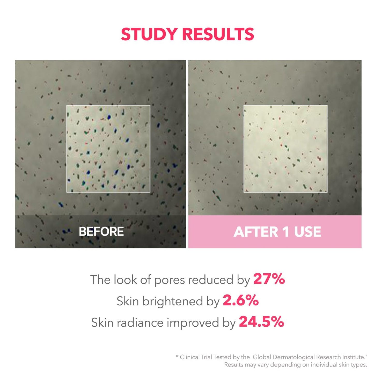 APRILSKIN TXA Niacinamide 99 Overnight Wrapping Mask - 80ml