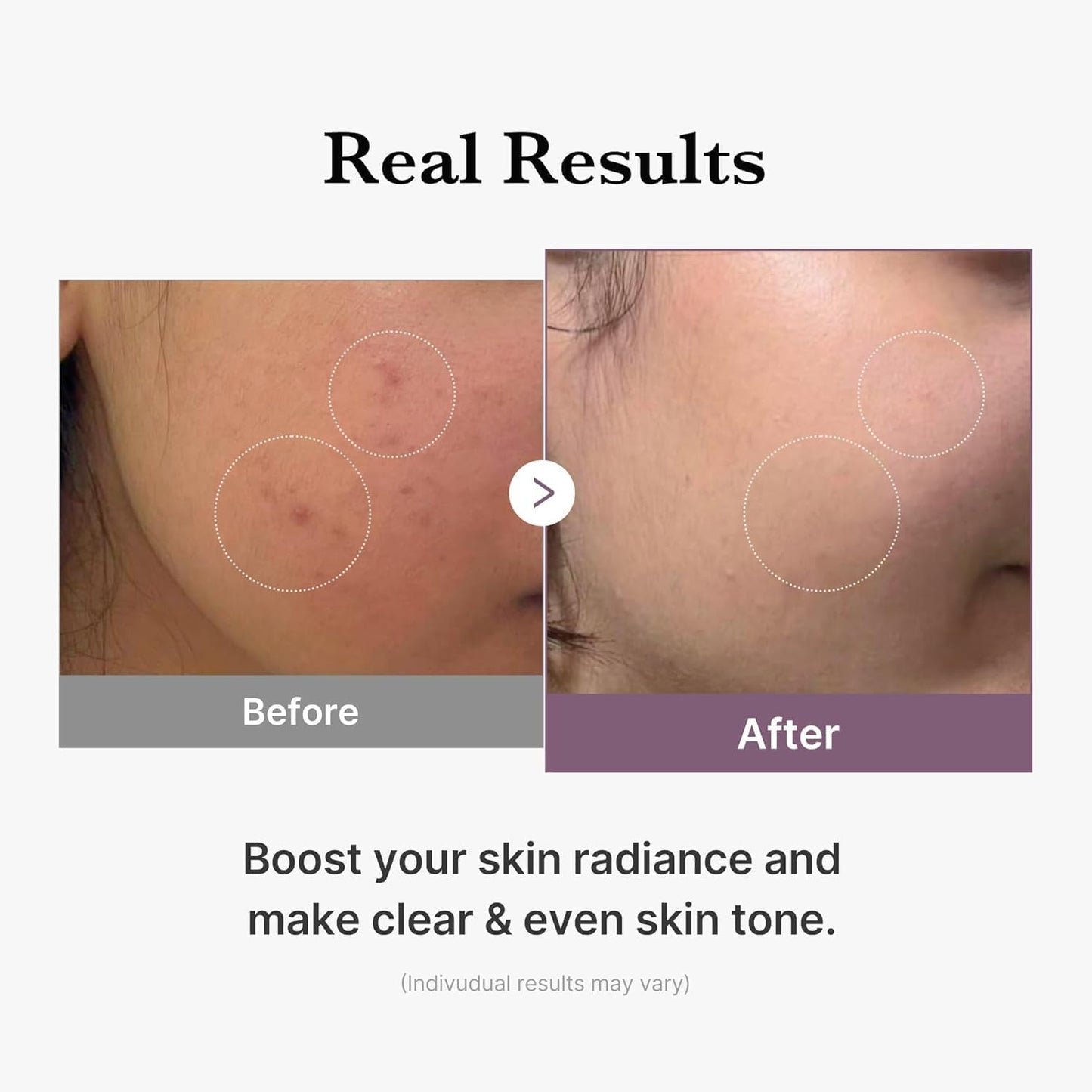 Medicube – Age-R Glutathione Glow Toner | 140ml