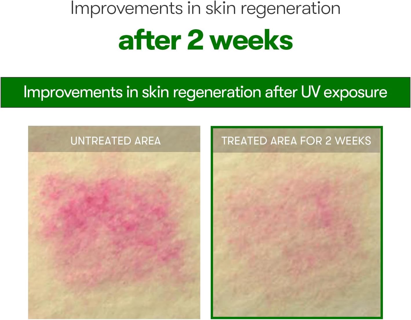 VT COSMETICS VT CICA Reedle Shot UAE