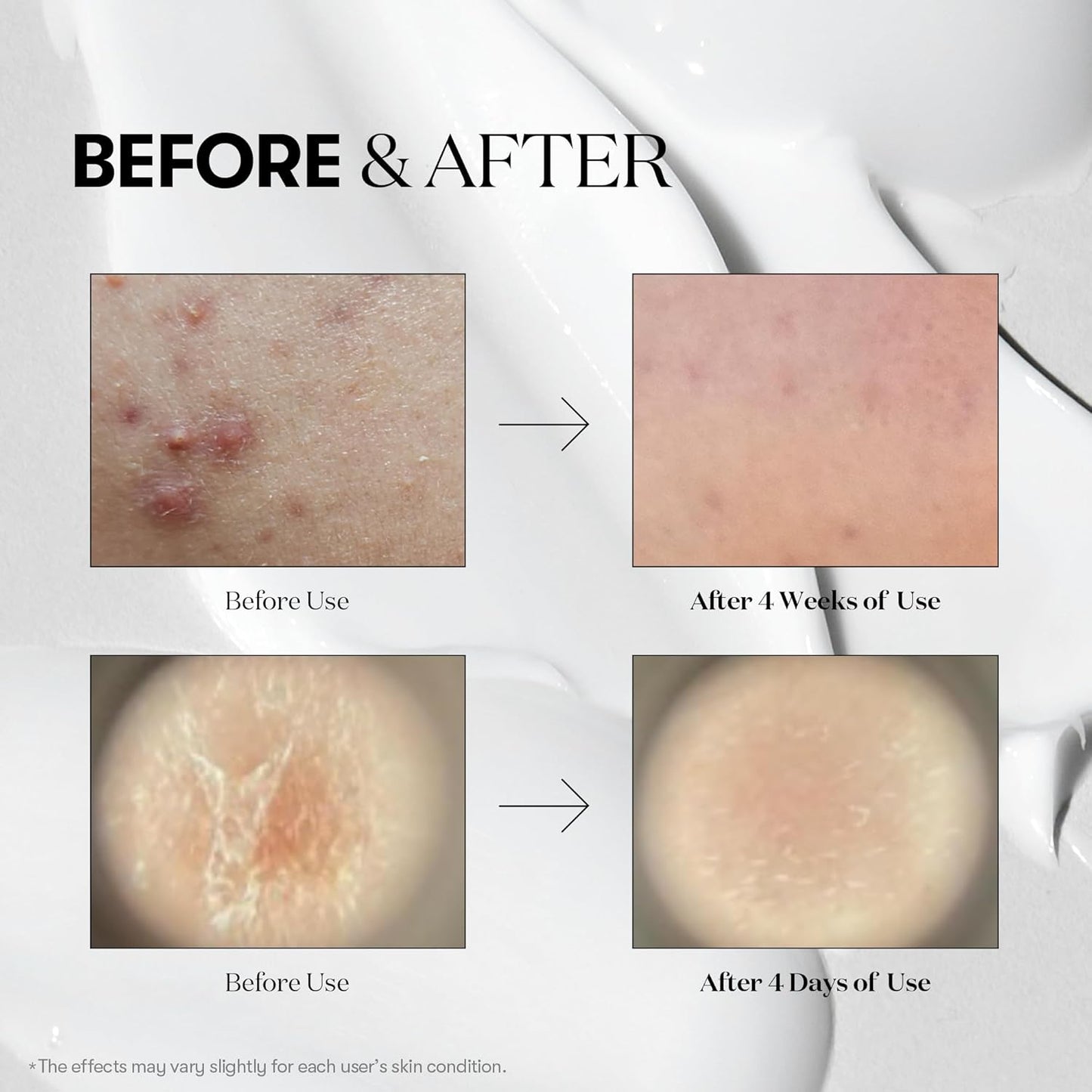 VT COSMETICS VT CICA Reedle Shot UAE