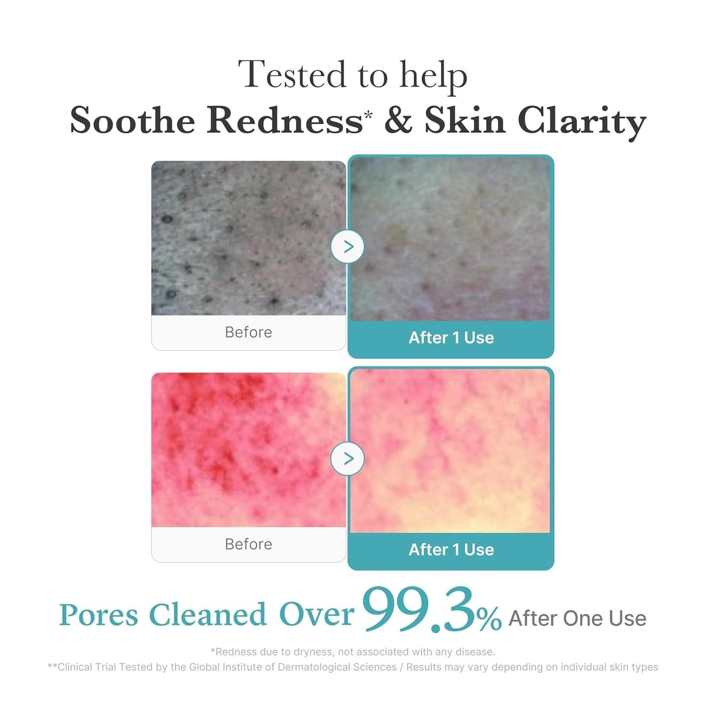 Medicube Azelaic Acid Niacinamide Deep Clean Foam – Deep Pore & Texture Cleanse -120 g