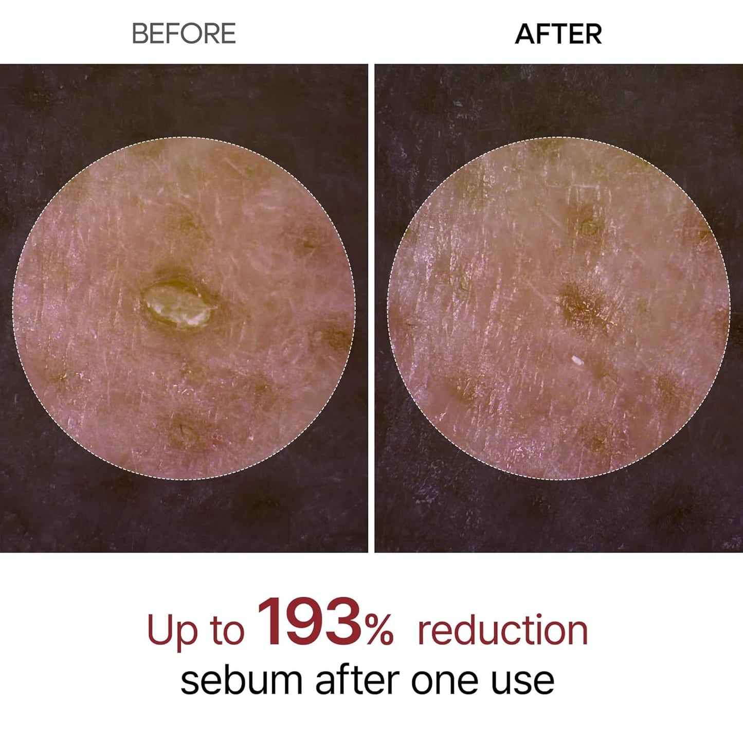 Dr. Melaxin Peel Shot Glow Black Rice Peeling Ampoule - 80 ml