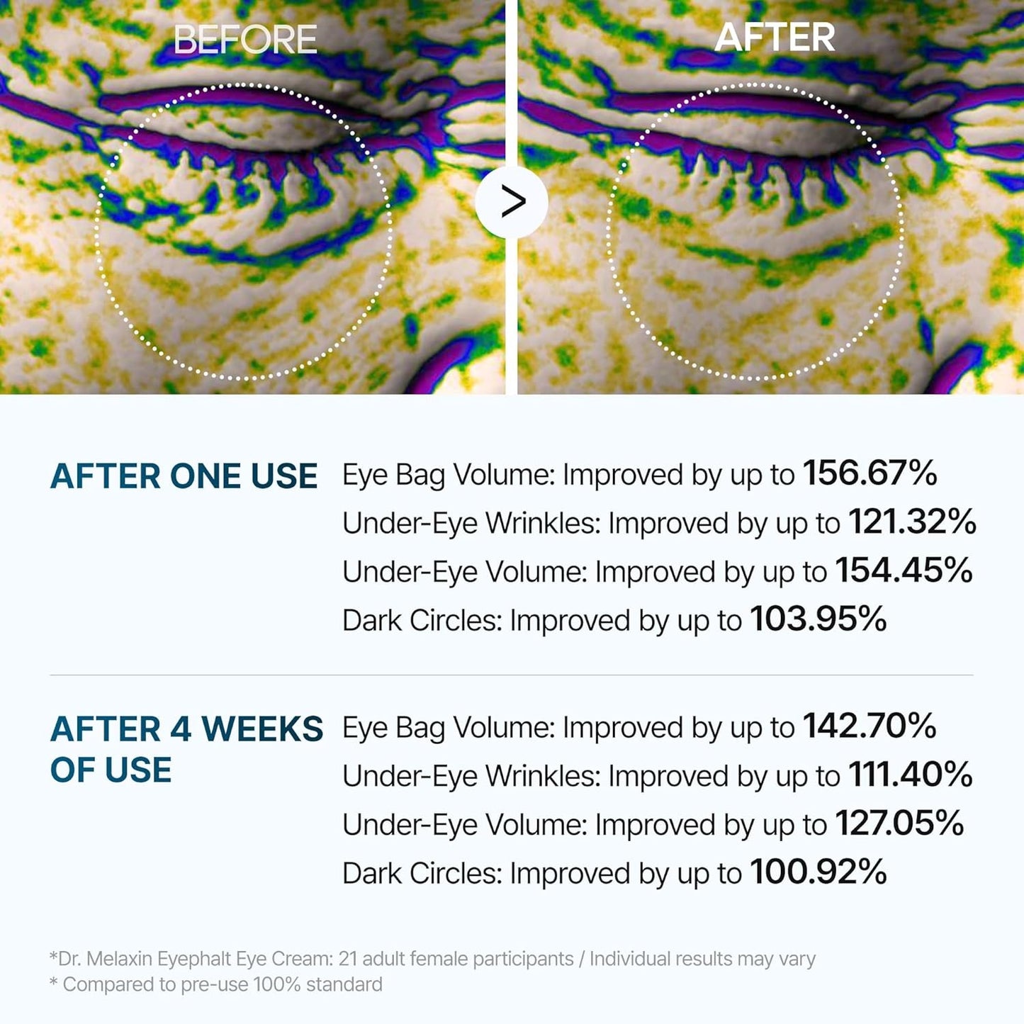 Dr. Melaxin Eyephalt Eyebag Cream - 10ml