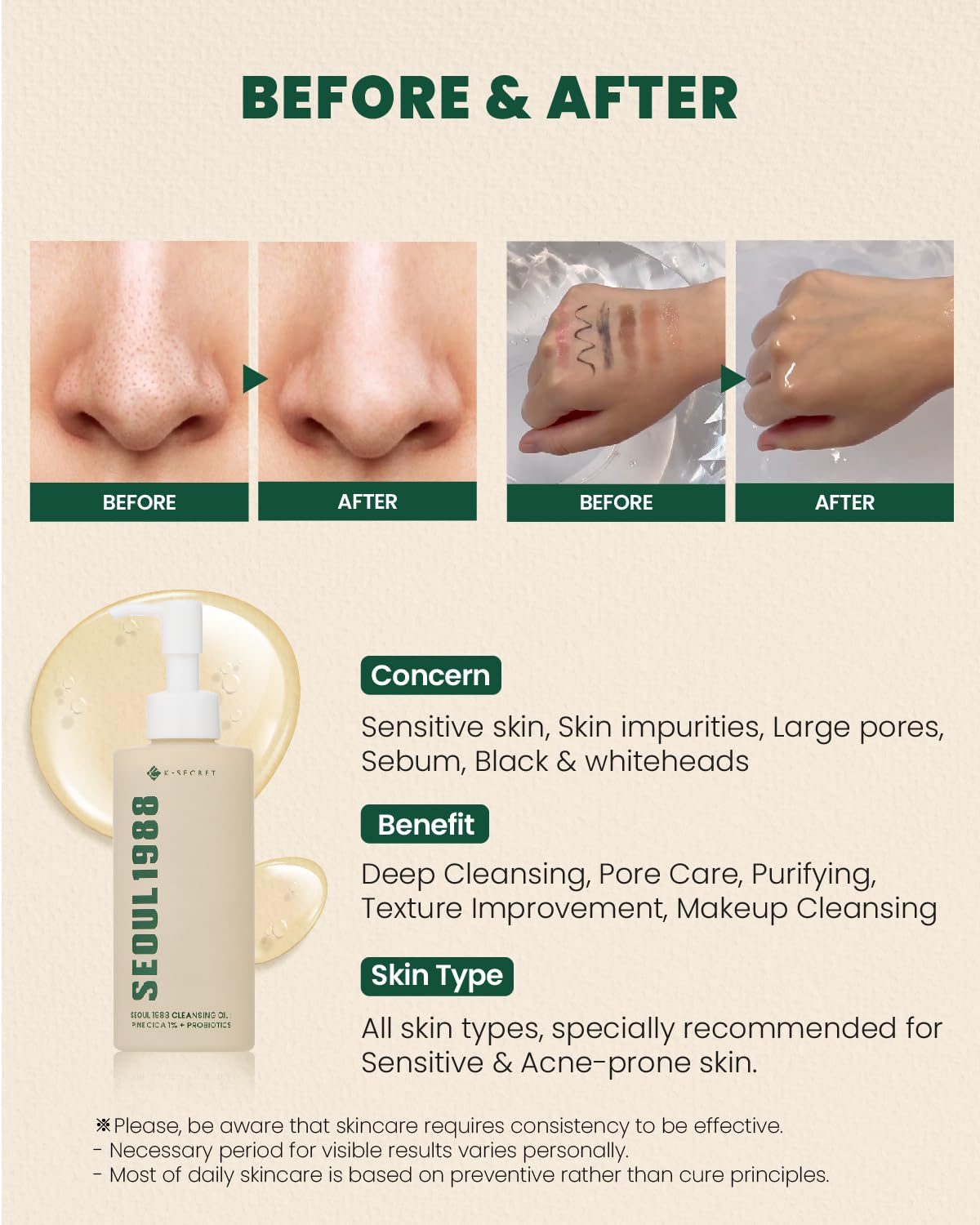 K-SECRET Seoul 1988 Cleansing Oil – Pine Cica 1% + Probiotics | 200ml