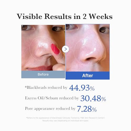 MEDICUBE Daily Zero Pore Reset Duo