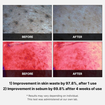 Medicube Swipe & Spray Red duo for Troubled Skin