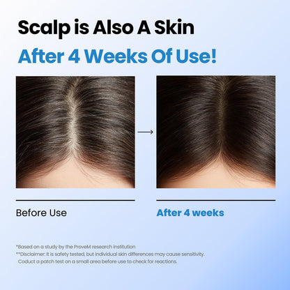 Seapuri Scalpy Hair Growth Serum - 20 ml