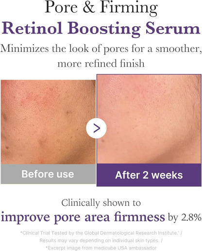 Medicube Retinol NMN Boosting Serum – Revive &amp; Firm Night Elixir - 30 ml&nbsp;