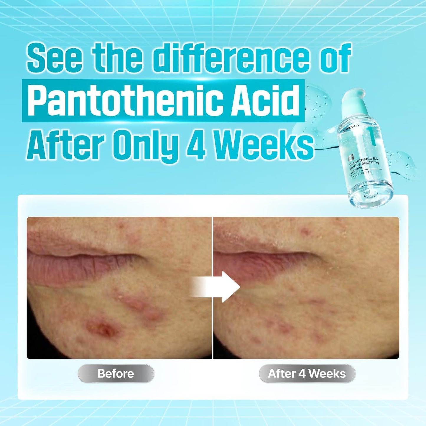 numbuzin No.1 Serum | Pantothenic B5 Active Soothing Serum