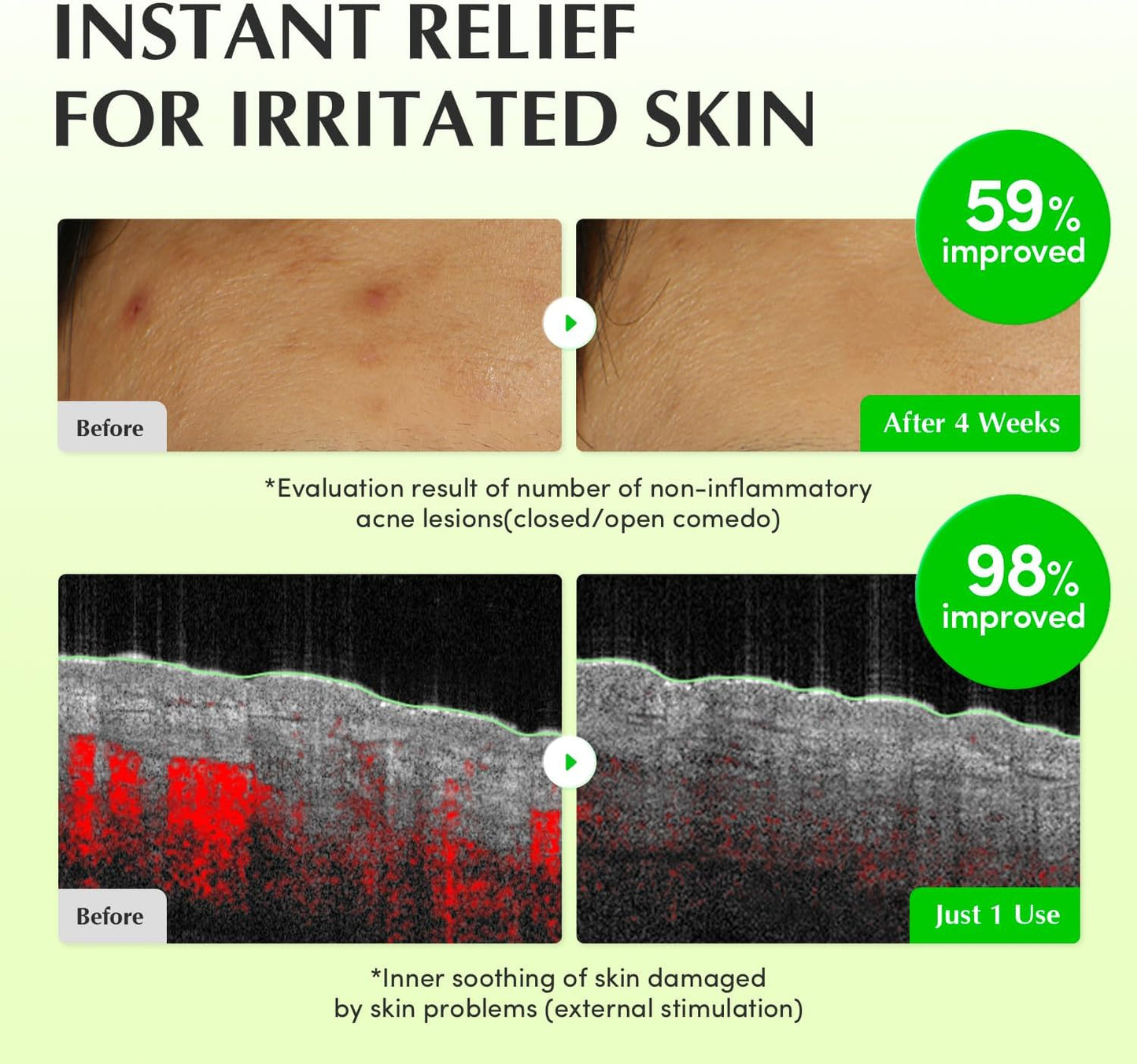 EQQUALBERRY Aloe PDRN Calming Toner 150ml