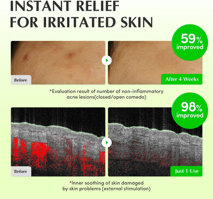 EQQUALBERRY Aloe PDRN Calming Toner 150ml