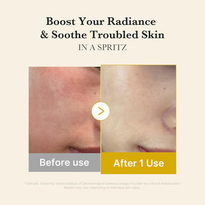 Medicube Turmeric Vitamin Gold Jelly Mist Serum - 100ml