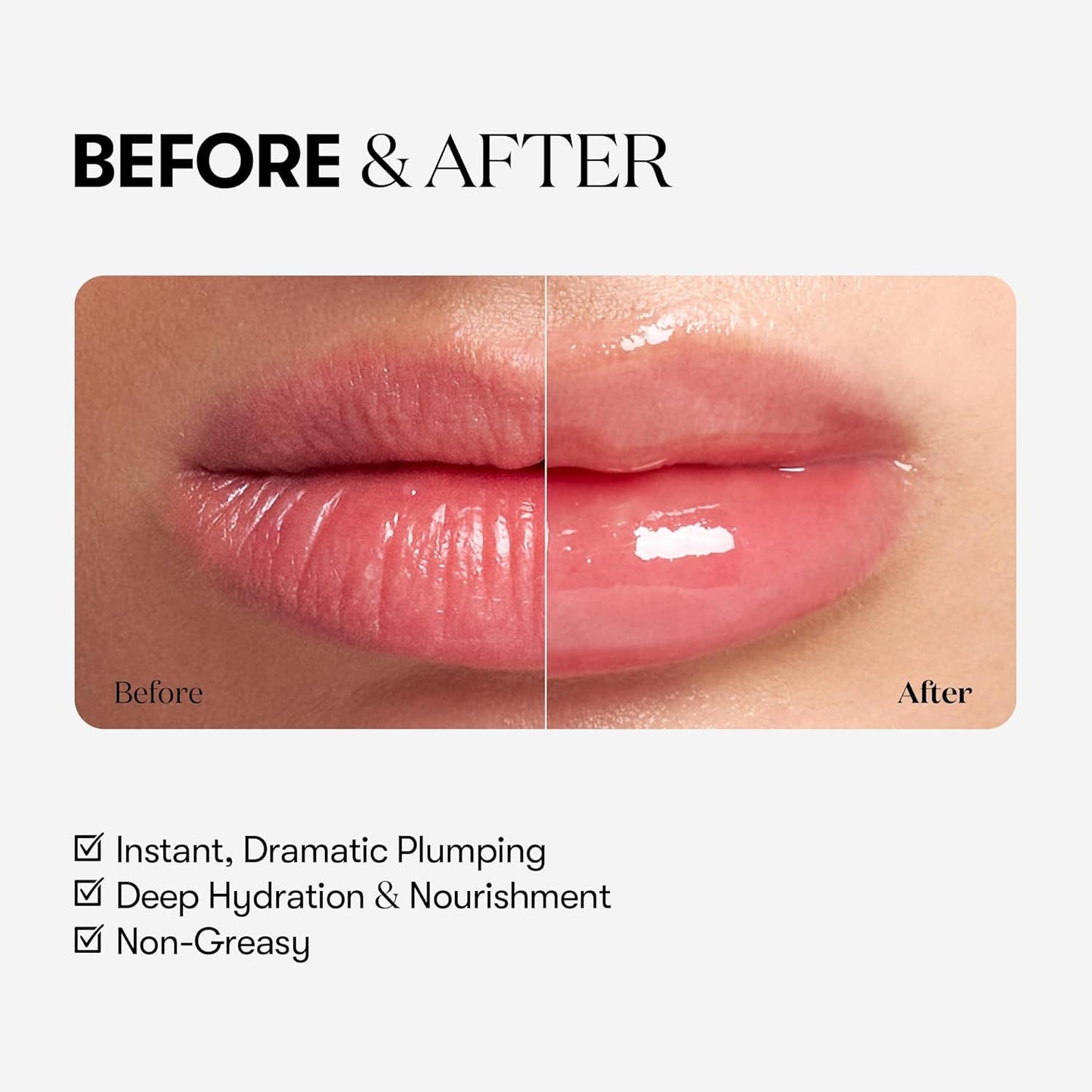 [VT COSMETICS] Reedle Shot Lip Plumper (Expert) 0.15 oz (4.3 g)