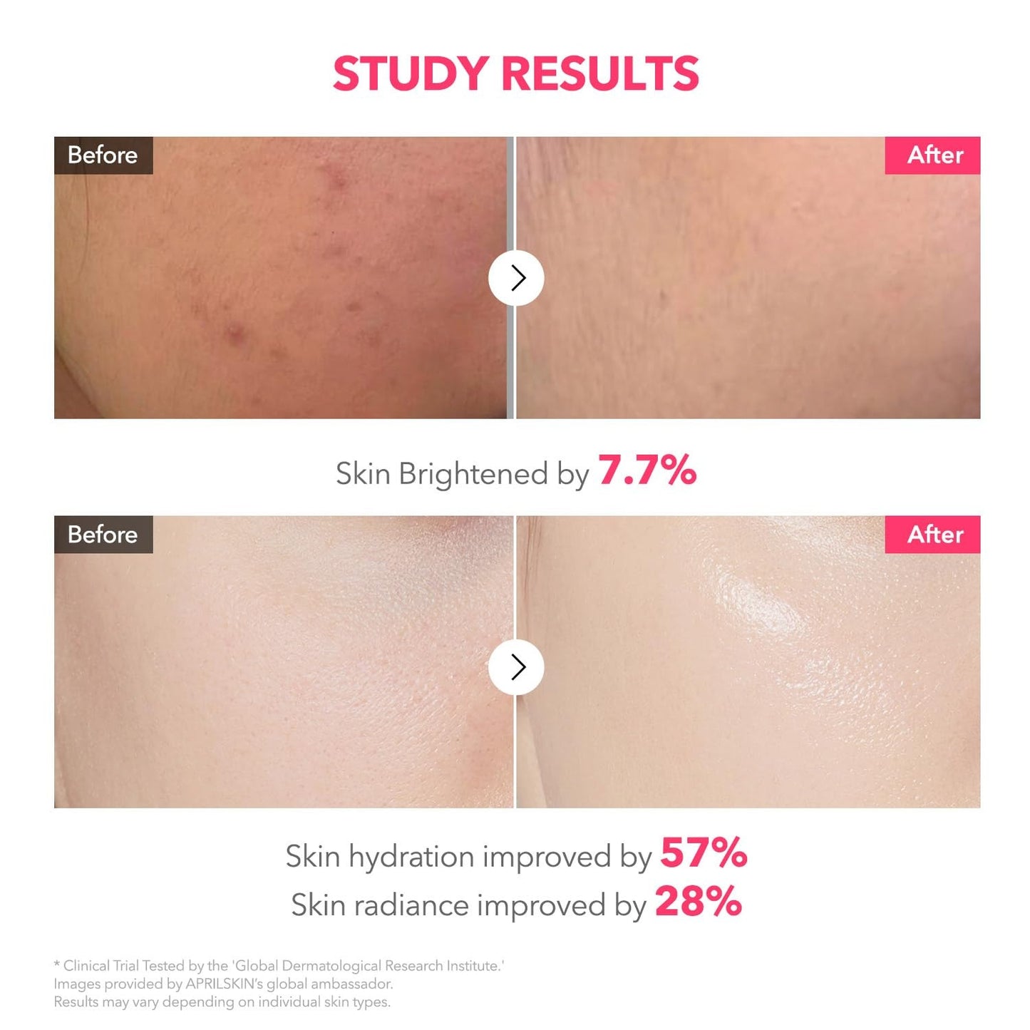 APRILSKIN TXA Pink Capsule Gel Mask - 30g x 4ea