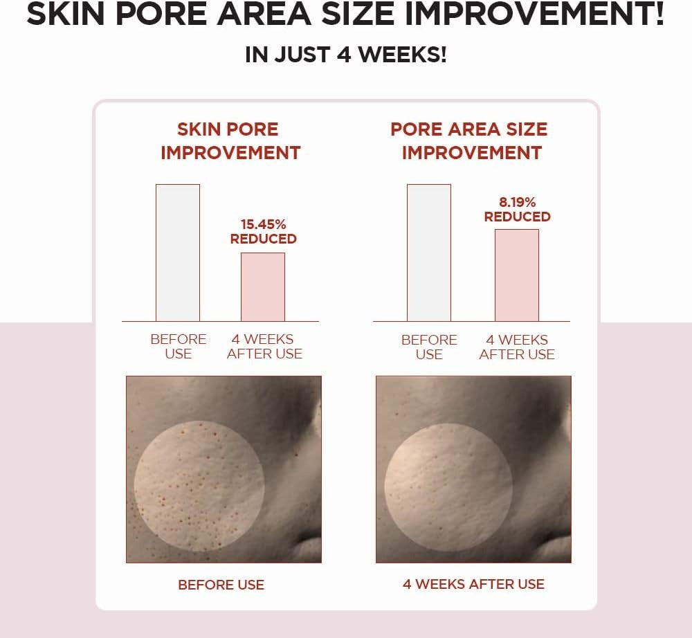 [SKIN 1004] Poremizing Clear Toner -210ml
