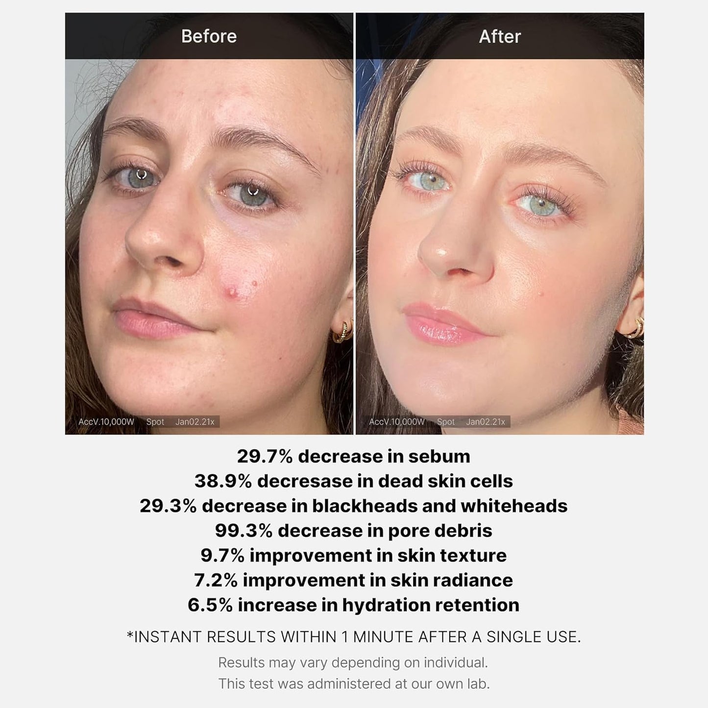 Medicube Red Acne Succinic Acid Peel - 40g