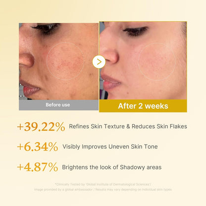 MEDICUBE Kojic Acid Turmeric Resurfacing Toner – “Glow & Renew Elixir” | 250 ml