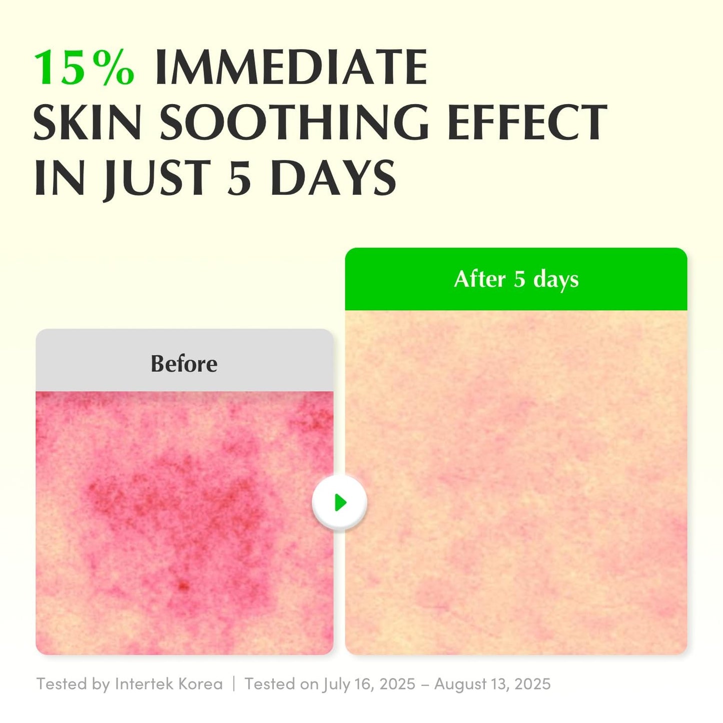 Eqqualberry Aloe PDRN Calming Smoothie Serum – Soothe & Restore Green Glow 30 ml