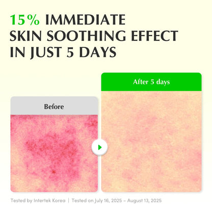 Eqqualberry Aloe PDRN Calming Smoothie Serum – Soothe & Restore Green Glow 30 ml