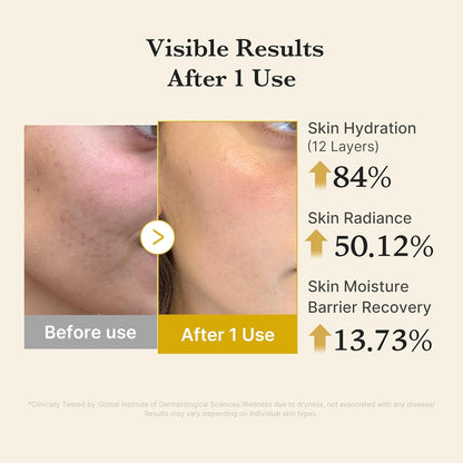 Medicube Turmeric Vitamin Gold Jelly Mist Serum - 100ml