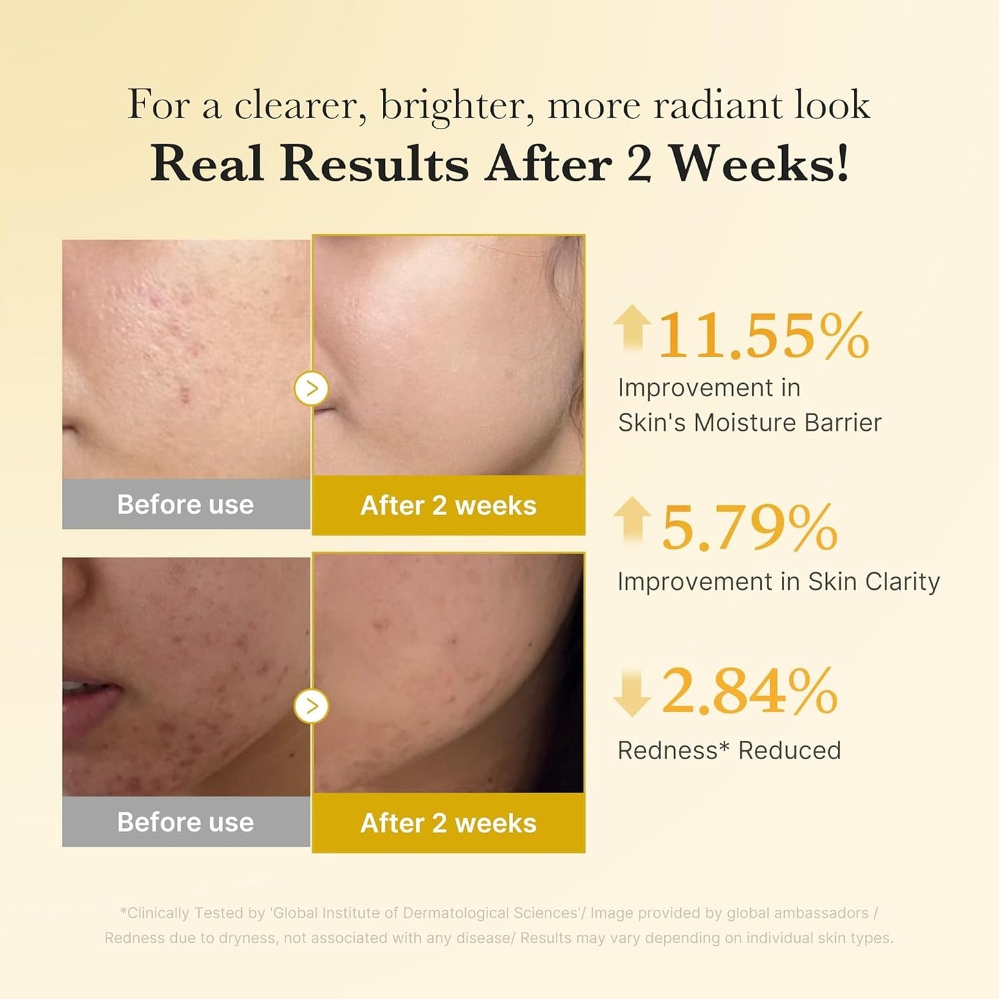 MEDICUBE Kojic Acid Turmeric Niacinamide Serum – Glow & Calm Radiance | 30 ml