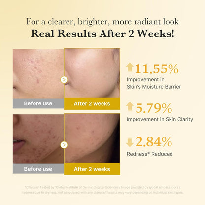 MEDICUBE Kojic Acid Turmeric Niacinamide Serum – Glow & Calm Radiance | 30 ml