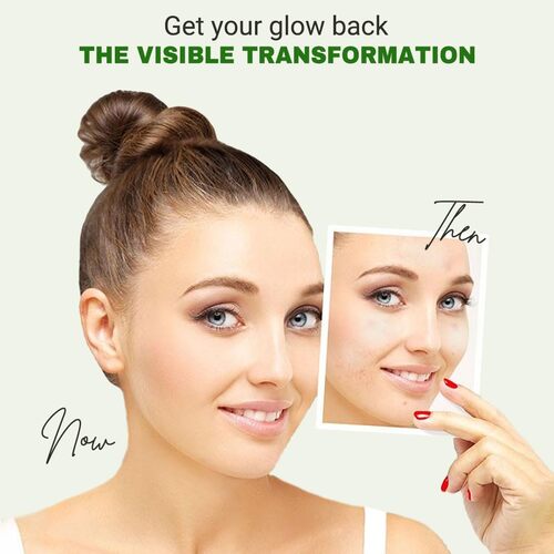 [Beauty of Joseon] Light On Serum : Centella + Vita C 30ml