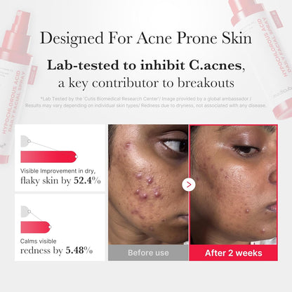 Medicube Swipe & Spray Red duo for Troubled Skin