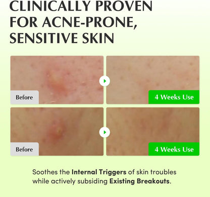 EQQUALBERRY Aloe PDRN Calming Toner 150ml