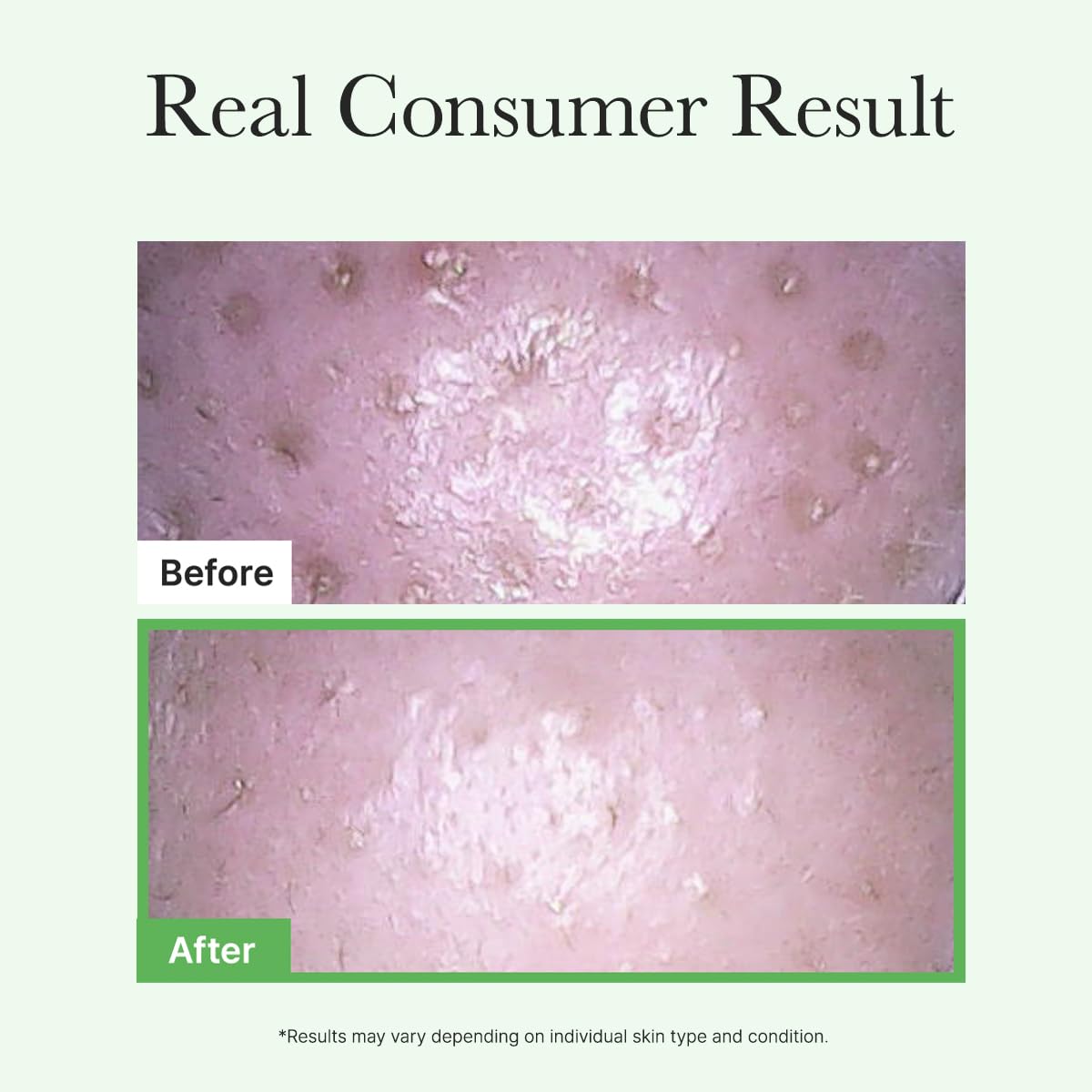 ARENCIA Pore Melt Mochi Makeup-Removing Cleansing Oil (Pack of 2) – 6.76 fl oz each ✨💧