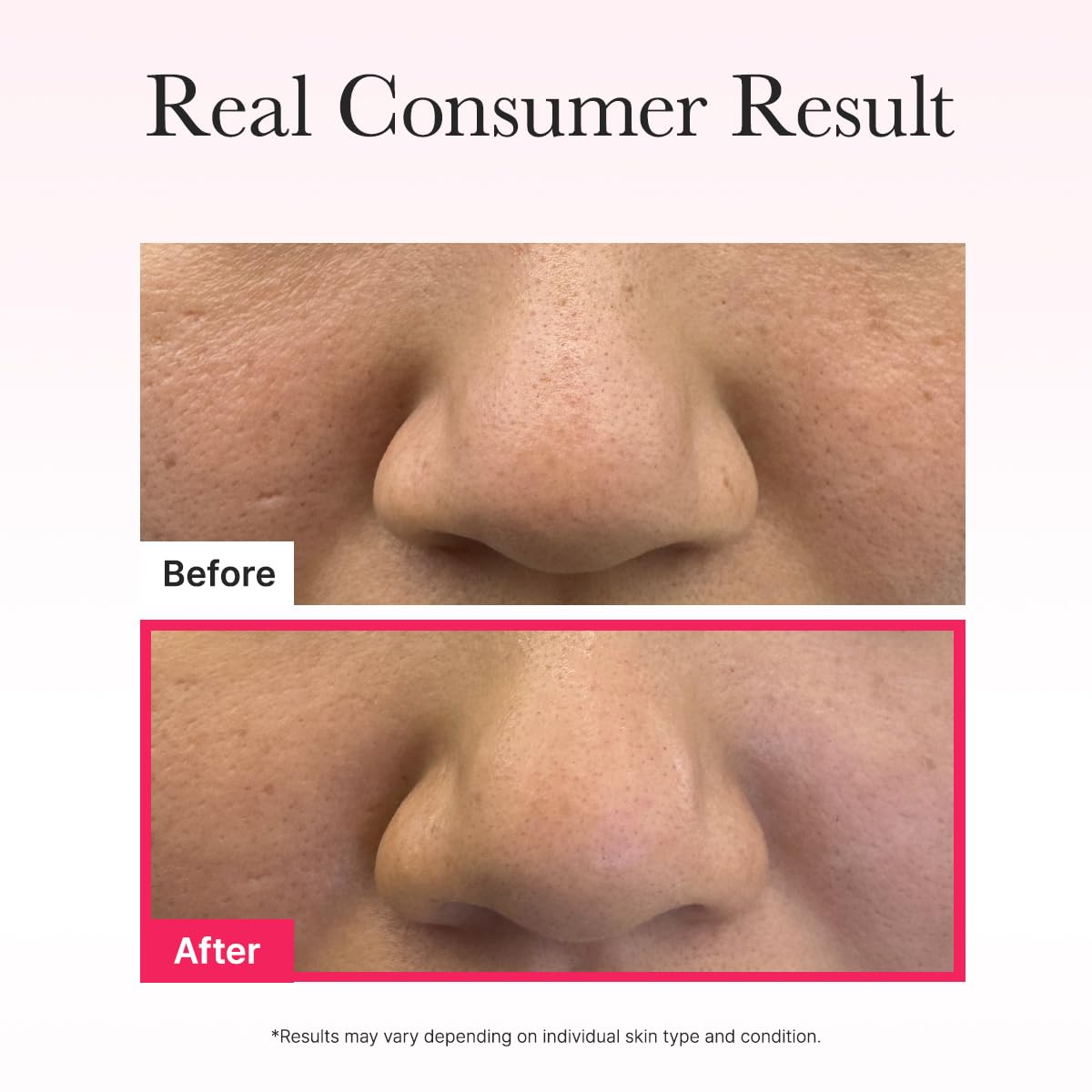 ARENCIA Red Collagen Jello Mask – Plump & Hydrating Overnight Hydrogel Mask (4ea) ❤️✨