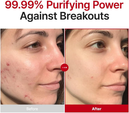 PURITO Hypochlorous Acid Facial Spray 100ml