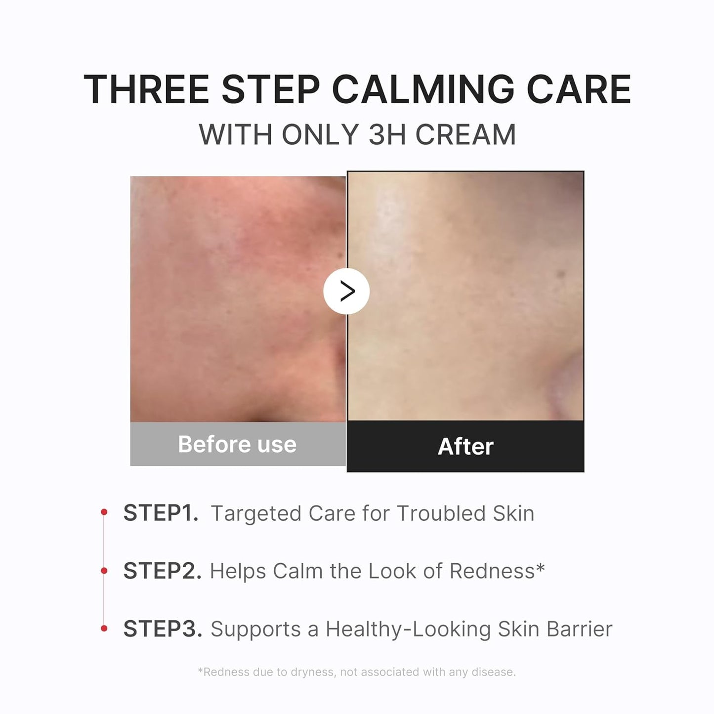 Medicube Comforting Serum & Cream Duo 💧✨