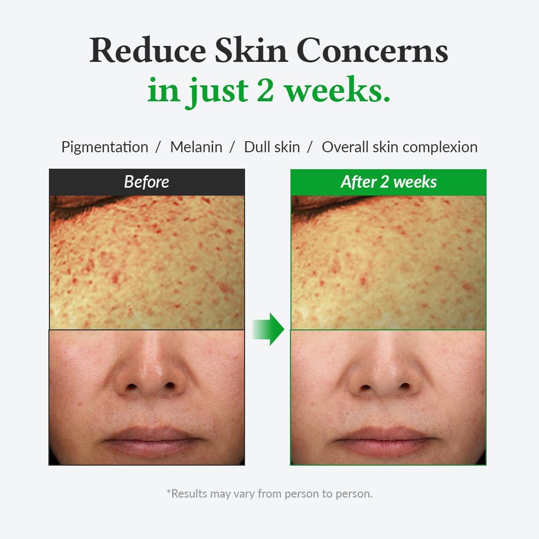 Dr.Althea Vitamin C Boosting Serum -30ml