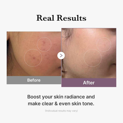 Medicube – Age-R Glutathione Glow Toner | 140ml