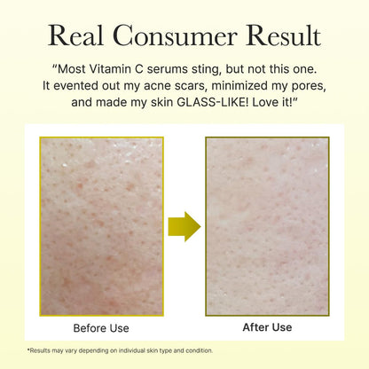 Arencia Vitamin C Booster Shot Serum (Pack of 2) – 30ml / 1.01 fl oz each 🍊✨