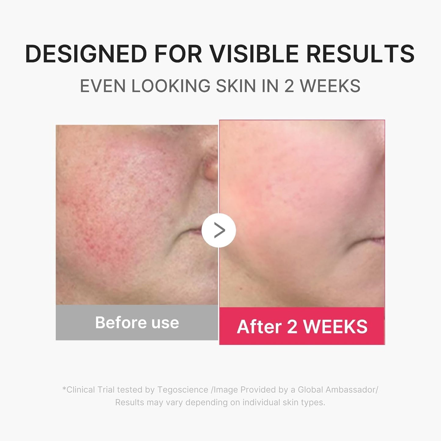 MEDICUBE All-in-One Skin Booster Device & Skincare Set