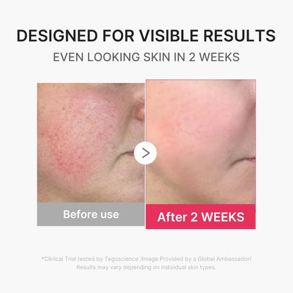 MEDICUBE All-in-One Skin Booster Device & Skincare Set