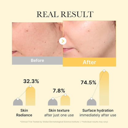 Medicube Kojic Acid Turmeric Gold Jelly Gel Mask | Brightening Overnight Face Mask