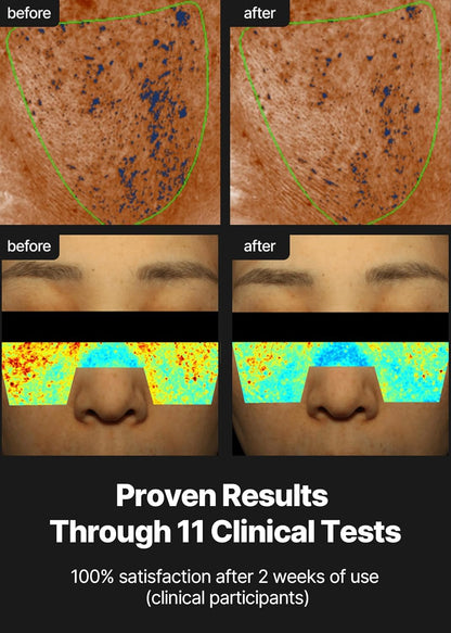 [Celimax] Pore+Dark Spot Brightening Cream