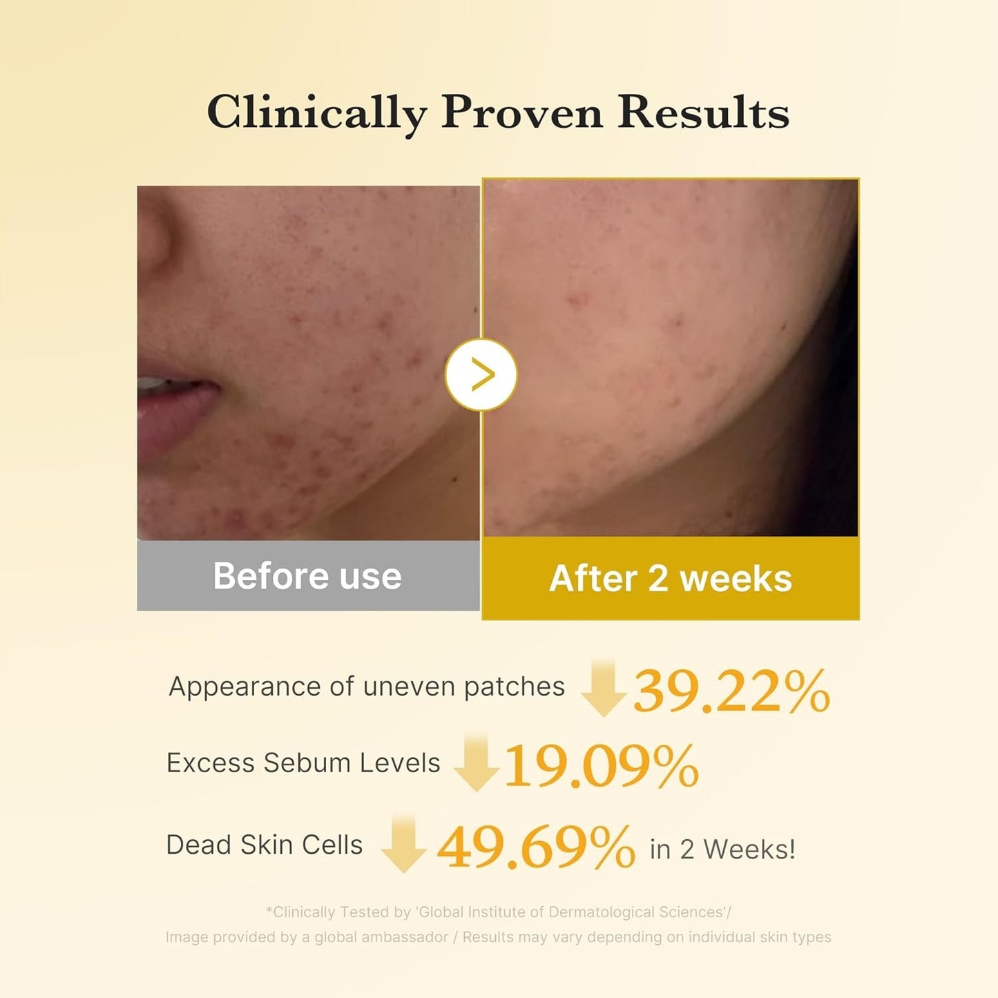 MEDICUBE Kojic Acid Turmeric Pad – Brightening & Soothing Glow-  70 Pads