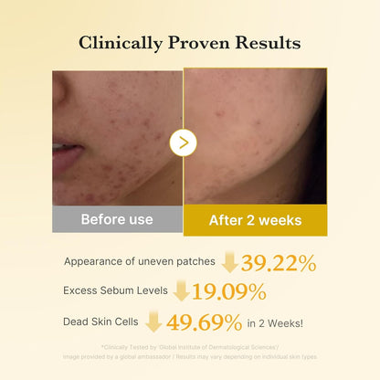 MEDICUBE Kojic Acid Turmeric Pad – Brightening & Soothing Glow-  70 Pads