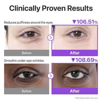 Numbuzin No.9 NAD Under Eye Patches – Revive & Depuff Eye Glow - 5 Pairs