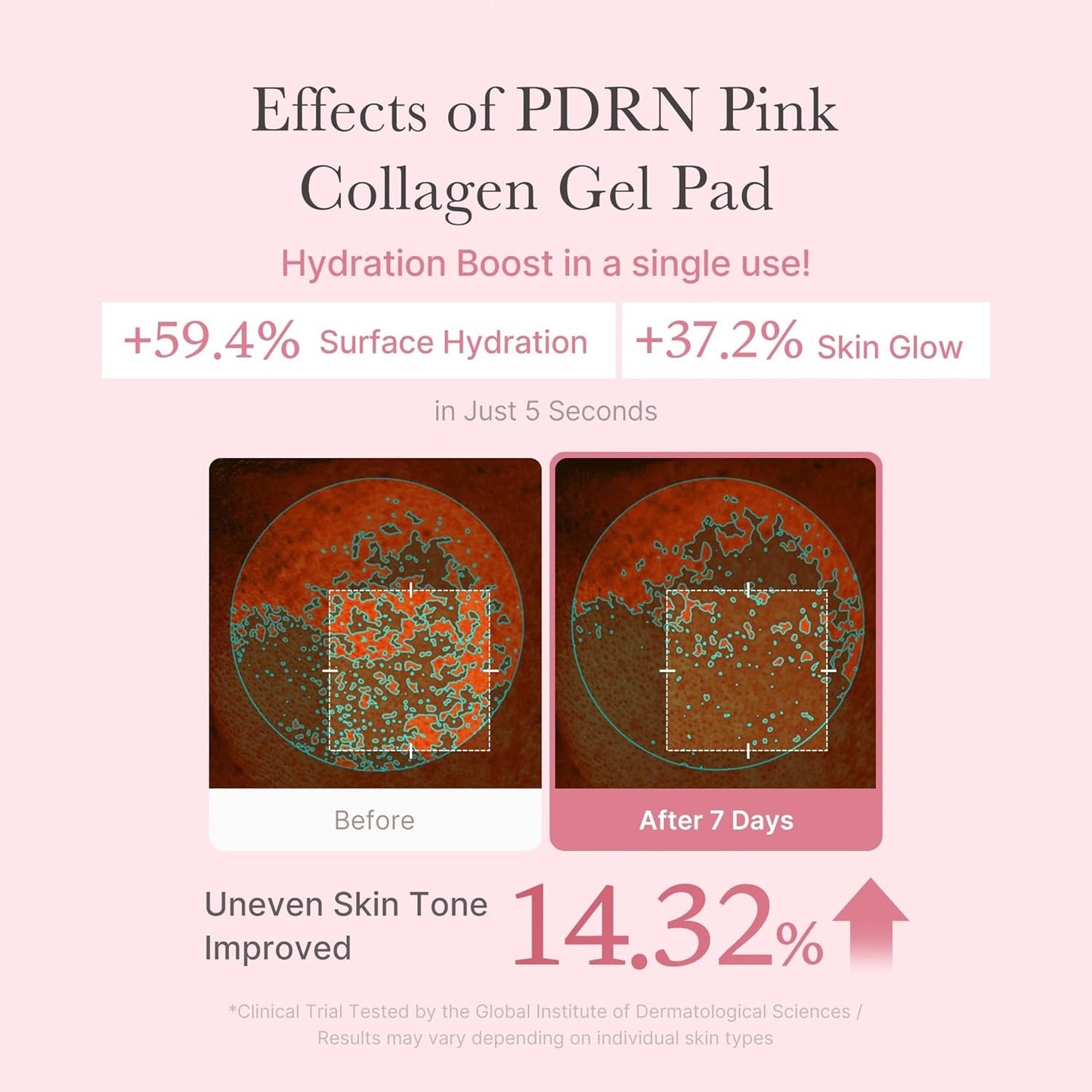 Medicube PDRN Pink Collagen Toning Gel Toner Pad - 70 pads