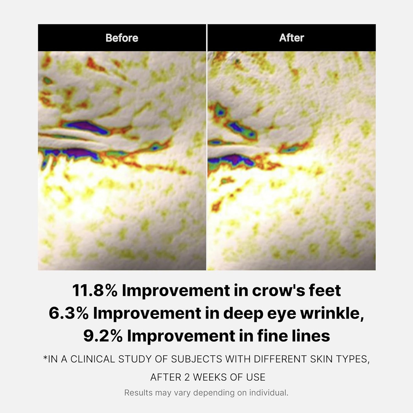 medicube Eye Serum Duo for Firmer-Looking Skin 👁️✨