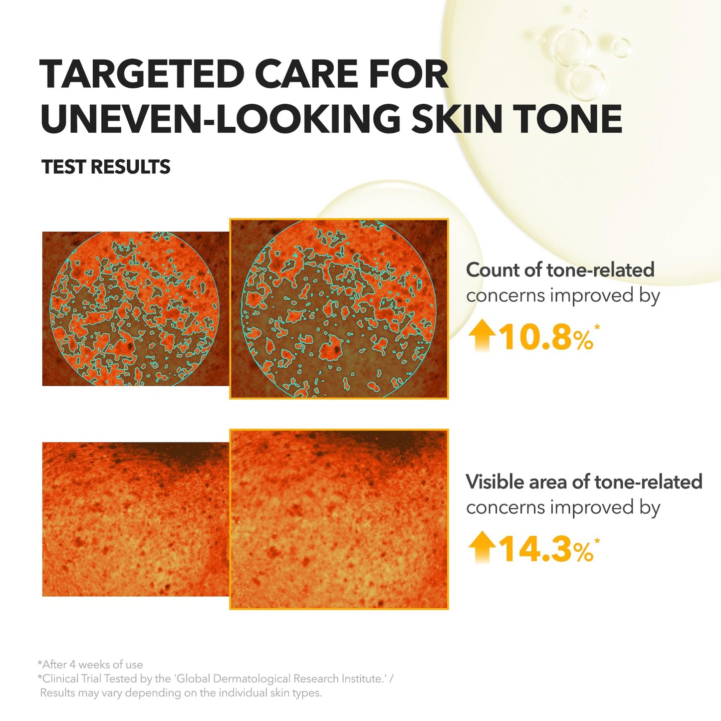 APRILSKIN A.C.E Serum – Vita Kojic Brightening Serum (3.88 oz / 110ml) ✨🍊