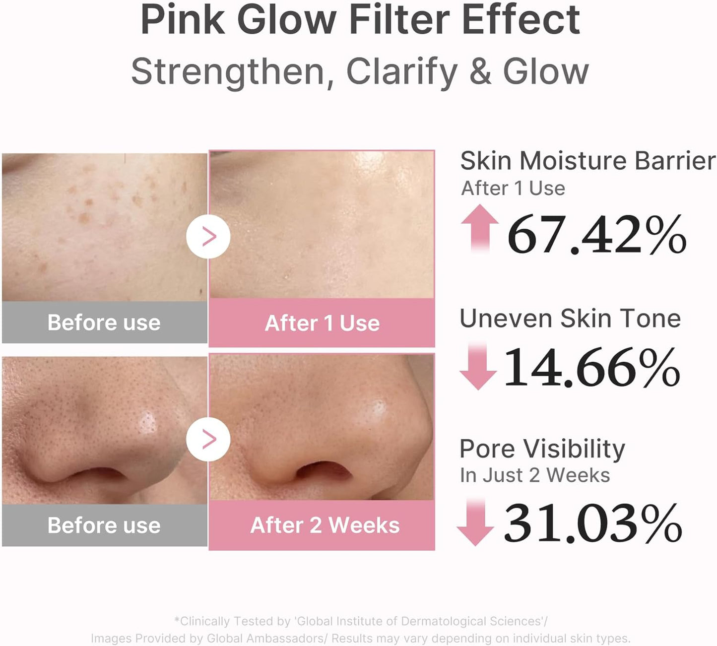 MEDICUBE All-in-One Skin Booster Device & Skincare Set - Pink